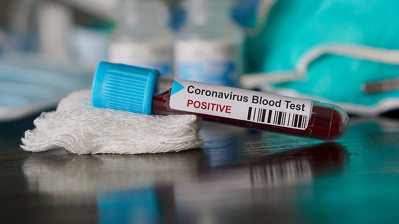 Már lehet magánúton koronavírus-tesztet végeztetni