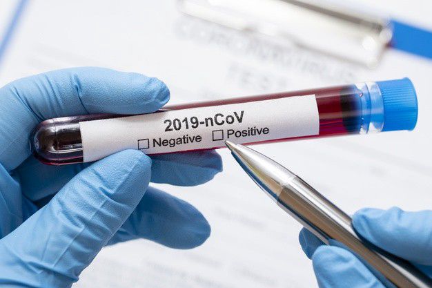 Koronavírus: 800 felett az új, igazolt fertőzöttek száma