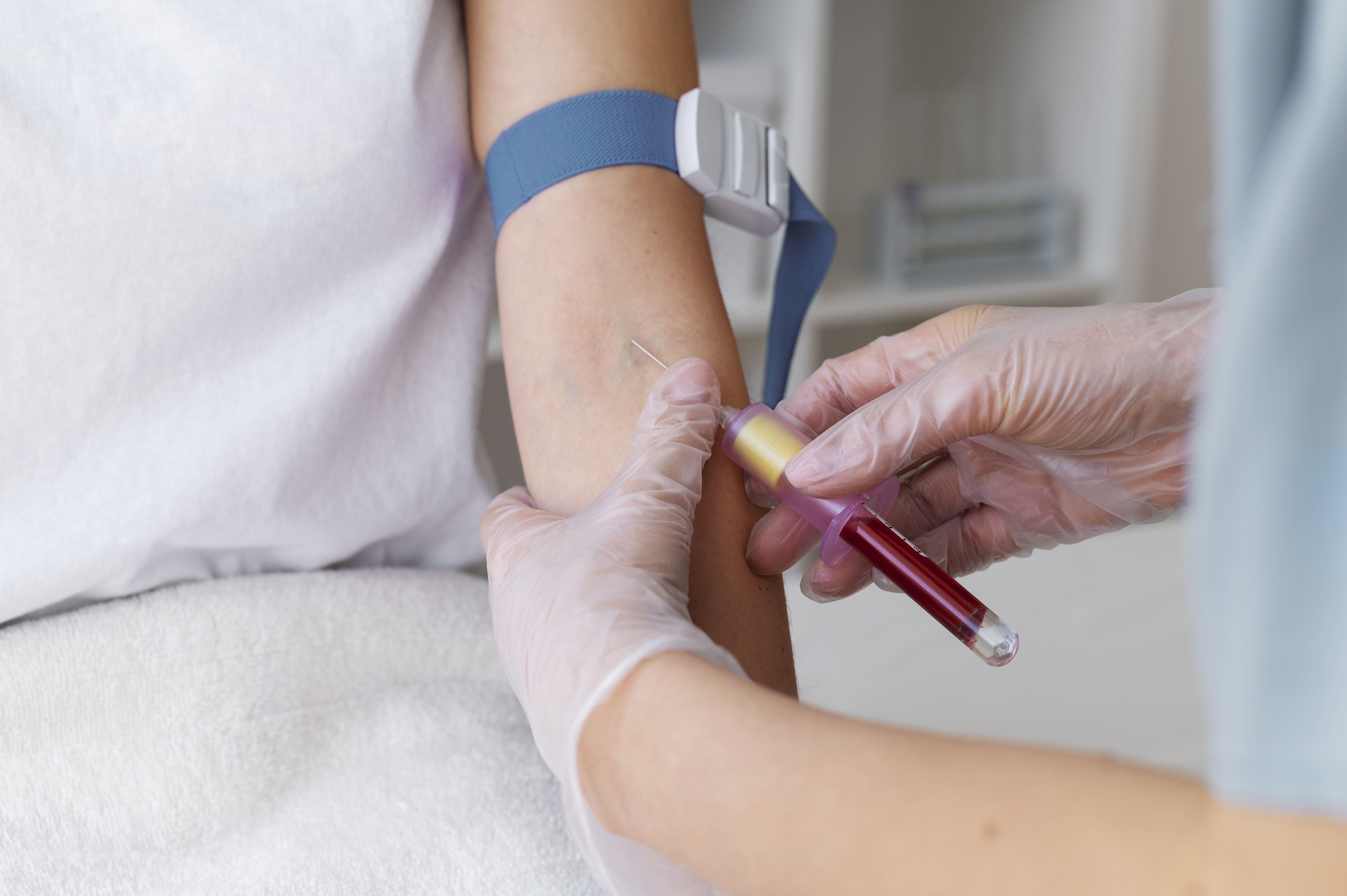 Nyugat-nílusi lázra is vizsgálják a véradáskor levett vért Nyugat-nílusi lázra is vizsgálják a véradáskor levett vért