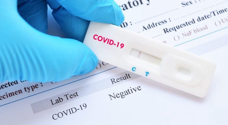 Csak negatív koronavírus-teszttel lehet beutazni Angliába
